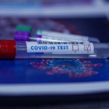Új koronavírus-gyorsteszt, egy órán belüli eredménnyel